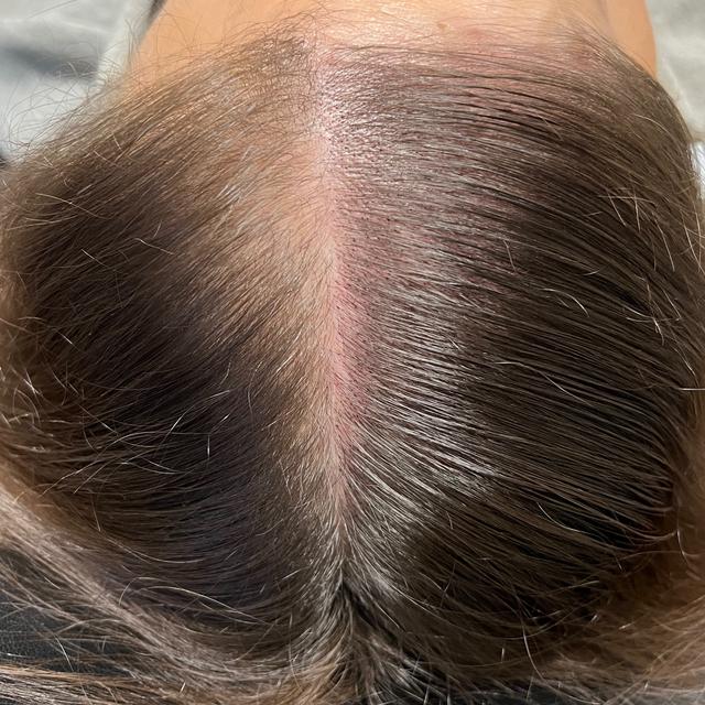 SMP Density Build Package